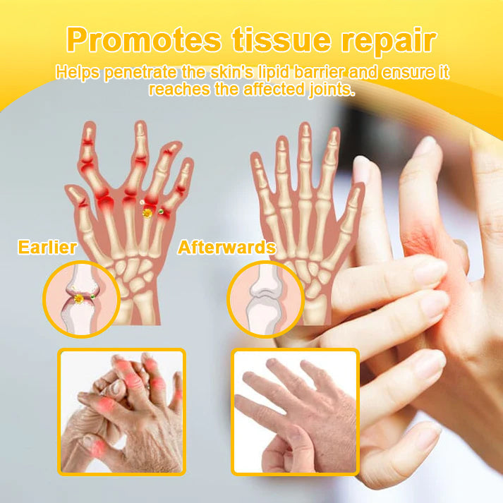 👨‍⚕️ NATRAVOR® Maximum-Strength Joint Relief Cream | 🐝 Botulinum Toxin + Bee Venom | ⚡ Fast-Acting Support for Pain, Stiffness, Swelling & Mobility | 🛡️ Full Refund Guarantee