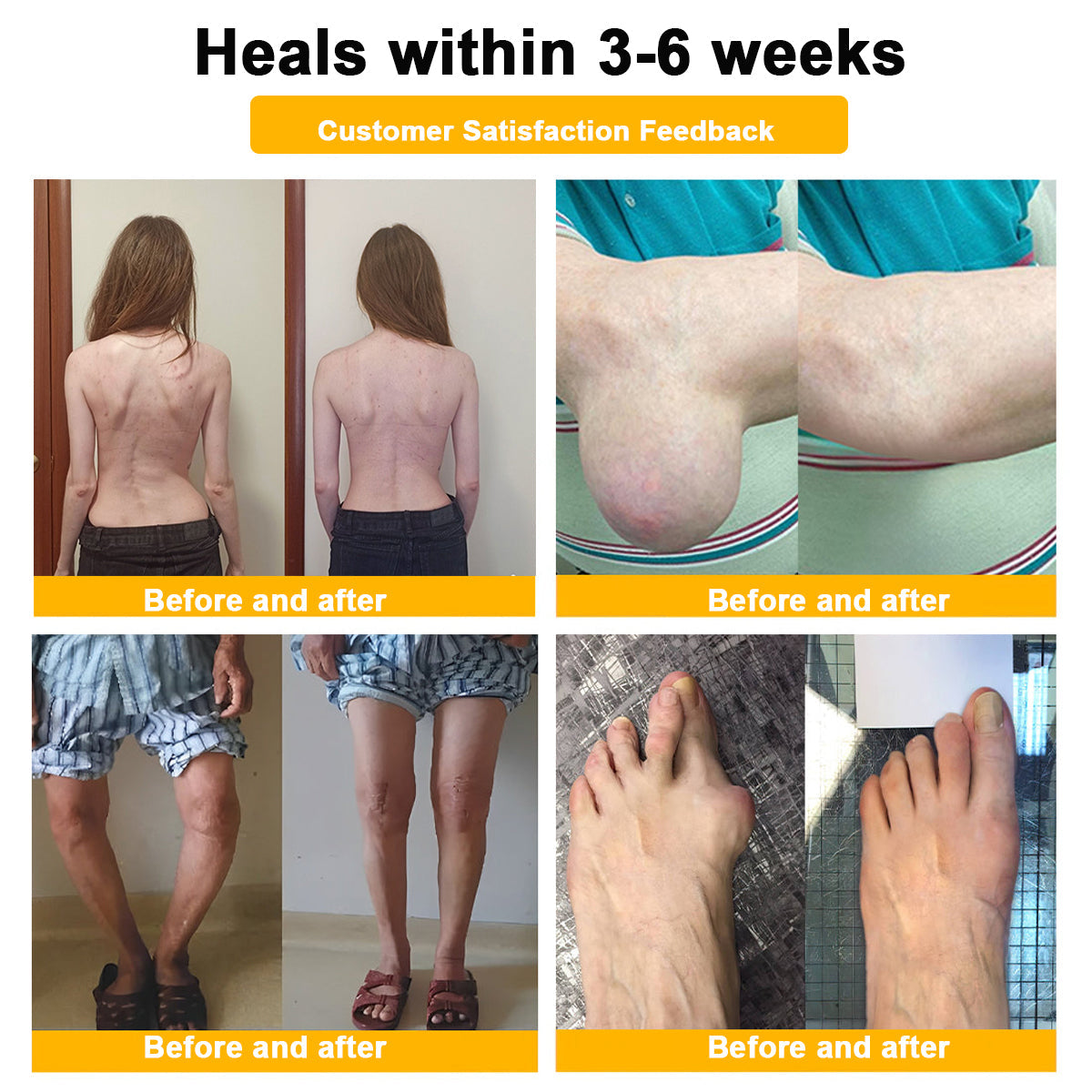 👨‍⚕️ NATRAVOR® Maximum-Strength Joint Relief Cream | 🐝 Botulinum Toxin + Bee Venom | ⚡ Fast-Acting Support for Pain, Stiffness, Swelling & Mobility | 🛡️ Full Refund Guarantee