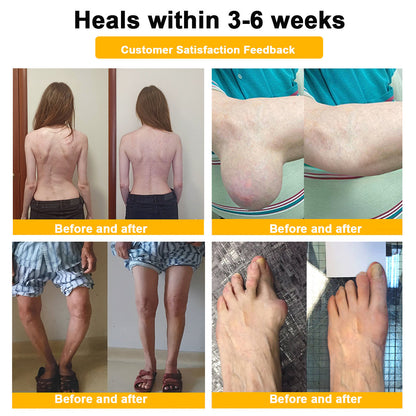 👨‍⚕️ NATRAVOR® Maximum-Strength Joint Relief Cream | 🐝 Botulinum Toxin + Bee Venom | ⚡ Fast-Acting Support for Pain, Stiffness, Swelling & Mobility | 🛡️ Full Refund Guarantee