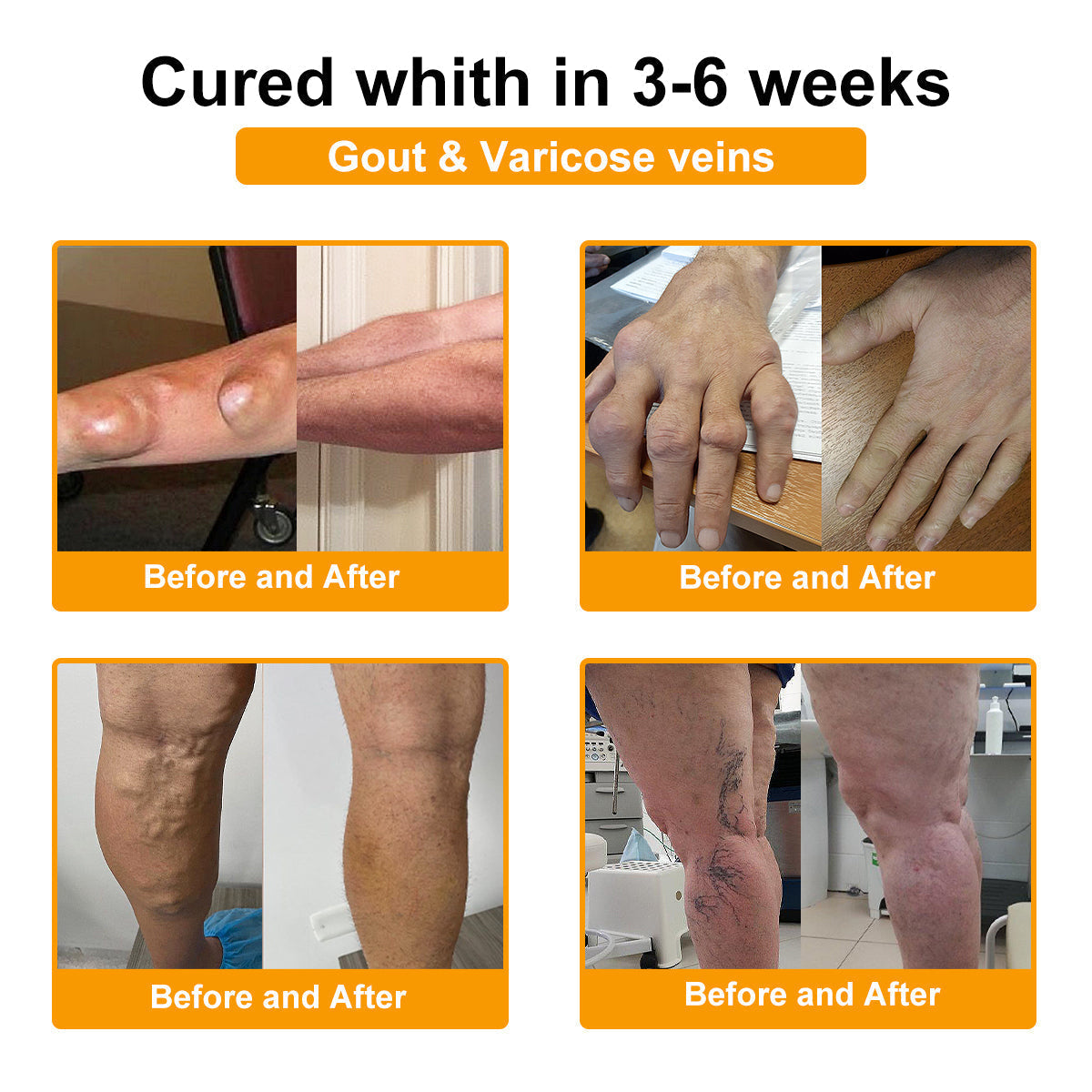 👨‍⚕️ NATRAVOR® Maximum-Strength Joint Relief Cream | 🐝 Botulinum Toxin + Bee Venom | ⚡ Fast-Acting Support for Pain, Stiffness, Swelling & Mobility | 🛡️ Full Refund Guarantee