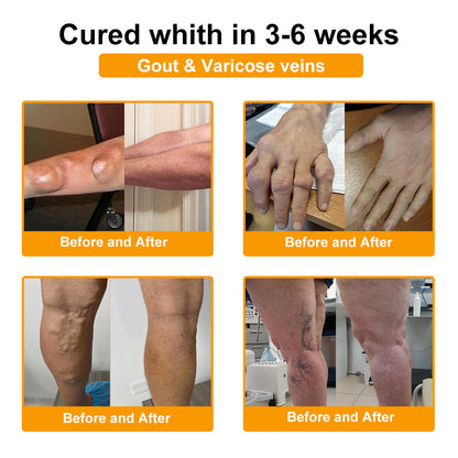 👨‍⚕️ NATRAVOR® Maximum-Strength Joint Relief Cream | 🐝 Botulinum Toxin + Bee Venom | ⚡ Fast-Acting Support for Pain, Stiffness, Swelling & Mobility | 🛡️ Full Refund Guarantee