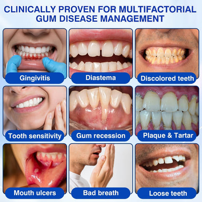 🦷 Evolvion® GumVital Advanced Gum Care Gel + 🎁 FREE Gum Care Kit