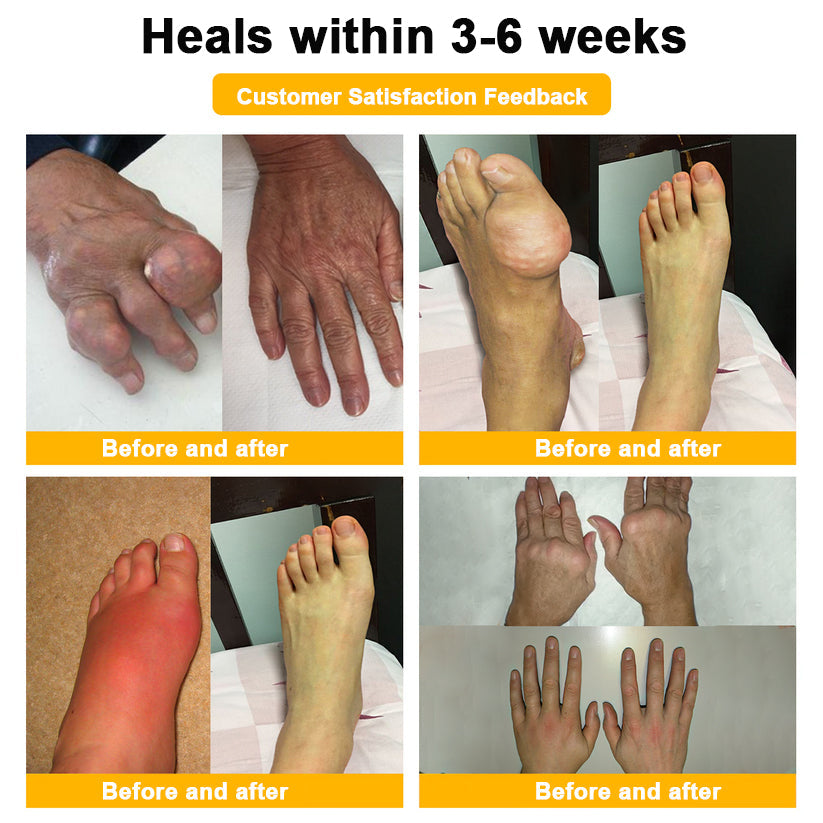 👨‍⚕️ NATRAVOR® Maximum-Strength Joint Relief Cream | 🐝 Botulinum Toxin + Bee Venom | ⚡ Fast-Acting Support for Pain, Stiffness, Swelling & Mobility | 🛡️ Full Refund Guarantee