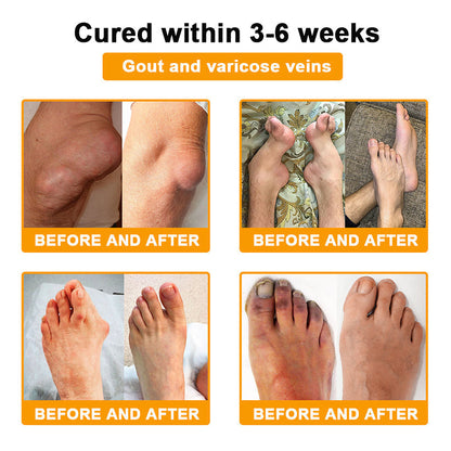 👨‍⚕️ NATRAVOR® Maximum-Strength Joint Relief Cream | 🐝 Botulinum Toxin + Bee Venom | ⚡ Fast-Acting Support for Pain, Stiffness, Swelling & Mobility | 🛡️ Full Refund Guarantee