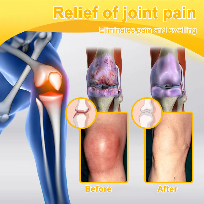 👨‍⚕️ NATRAVOR® Maximum-Strength Joint Relief Cream | 🐝 Botulinum Toxin + Bee Venom | ⚡ Fast-Acting Support for Pain, Stiffness, Swelling & Mobility | 🛡️ Full Refund Guarantee