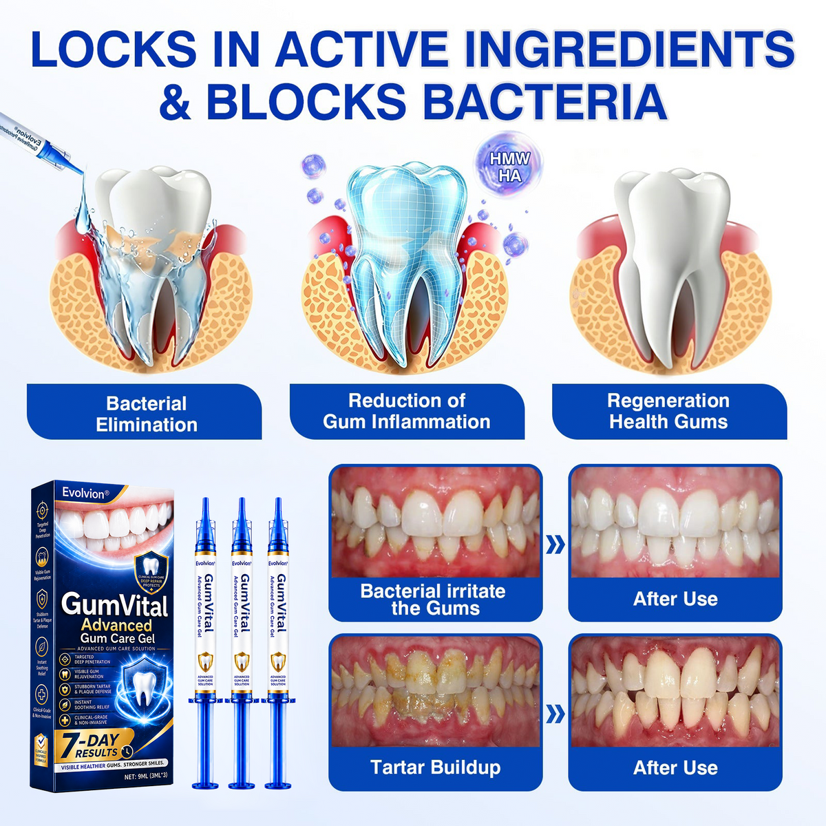 🦷 Evolvion® GumVital Advanced Gum Care Gel + 🎁 FREE Gum Care Kit