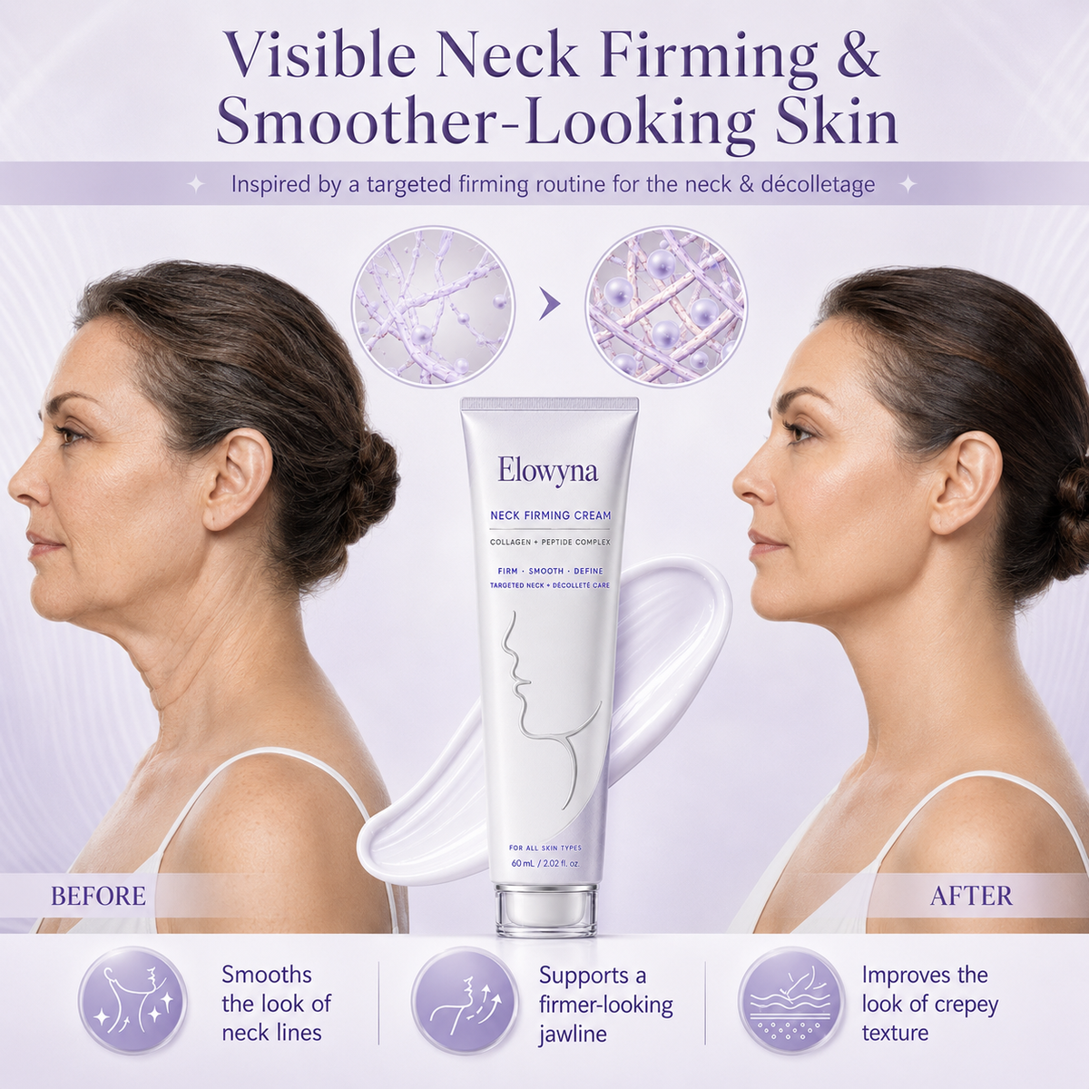 🧠👩‍🔬 Elowyna All-Over Firming Cream – FDA-Compliant Formula For Face, Neck & Body – Smooth, Tighten & Brighten – 70% OFF + 🎁 Free Derma Roller Today