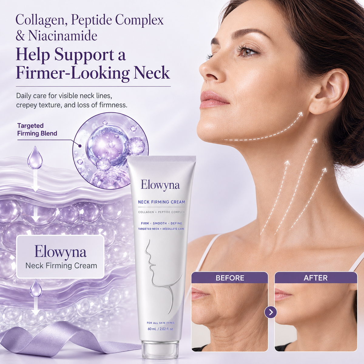 🧠👩‍🔬 Elowyna All-Over Firming Cream – FDA-Compliant Formula For Face, Neck & Body – Smooth, Tighten & Brighten – 70% OFF + 🎁 Free Derma Roller Today